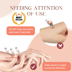5-in-1 Blackhead Remover
