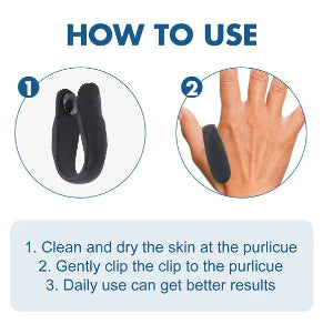 Sugar Control LI4 Acupressure Point Clip